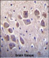DSCR1L1 Antibody (N-term)
